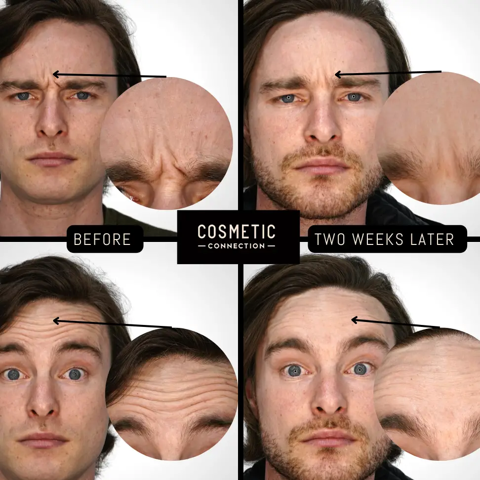 Tratamientos cosméticos para hombres - Cosmetic Connection
